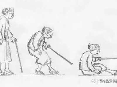 髋部骨折堪称人生最后一次骨折